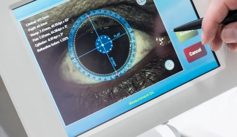 Topografía corneal en Imax Ópticos